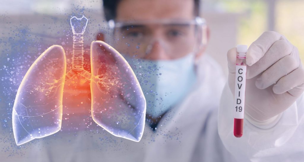 Murieron más de 110 personas por coronavirus en nuestra región